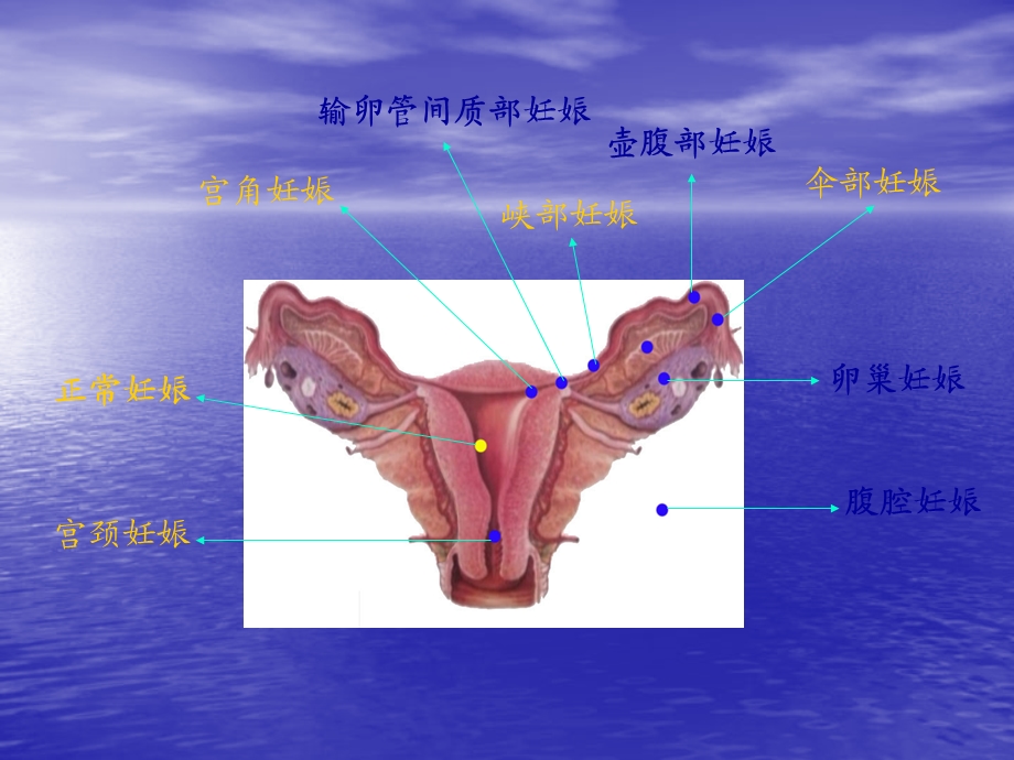 妇科急腹痛诊治思路.ppt_第3页