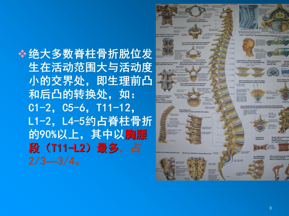 脊柱骨折和脊髓损伤PPT课件.ppt_第3页