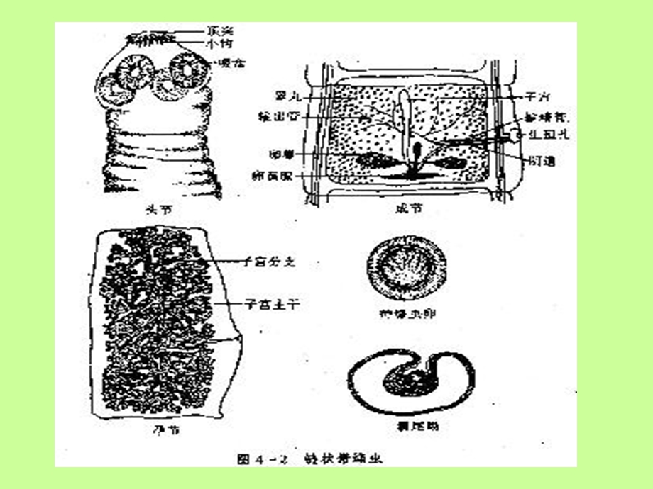 绦虫tapeworm.ppt_第3页