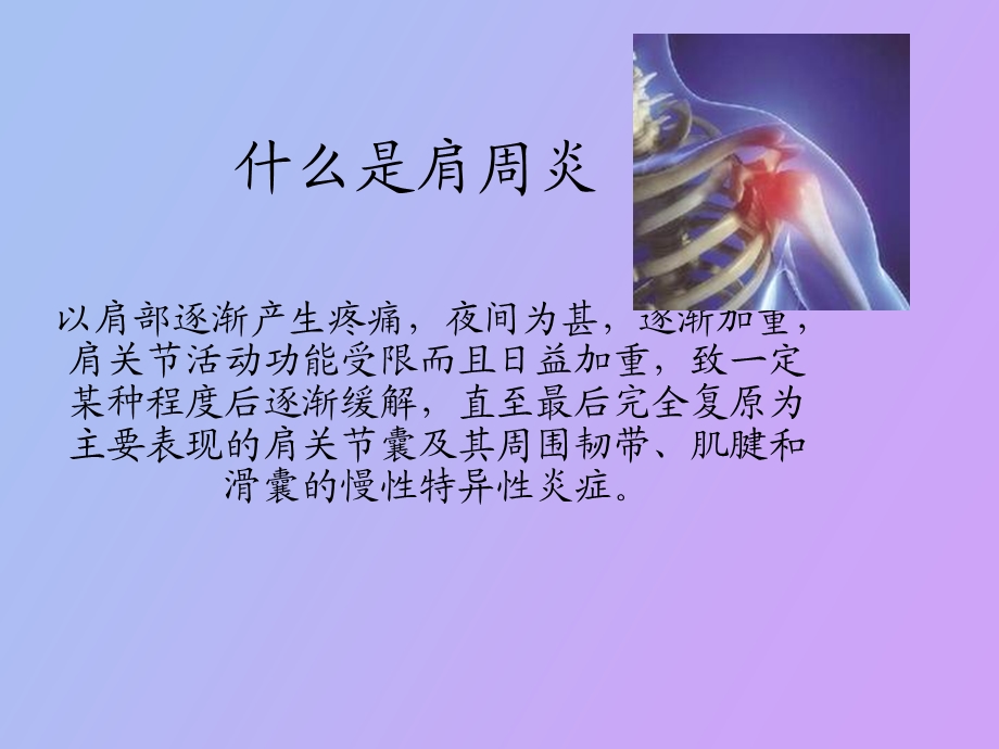 肩周炎的医疗体育.ppt_第2页