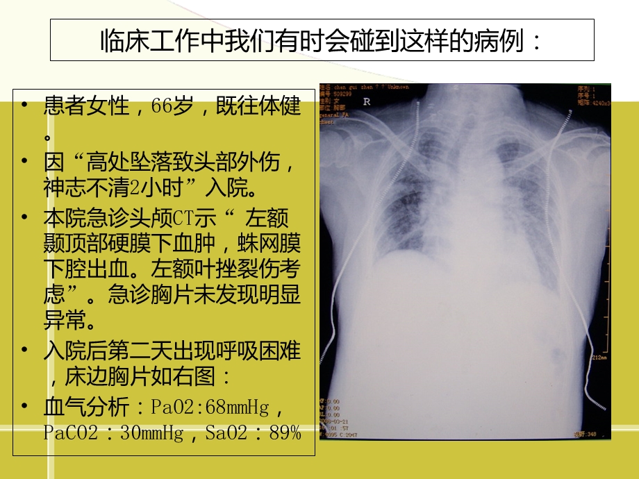 顽固性低氧血症的诊治.ppt_第2页