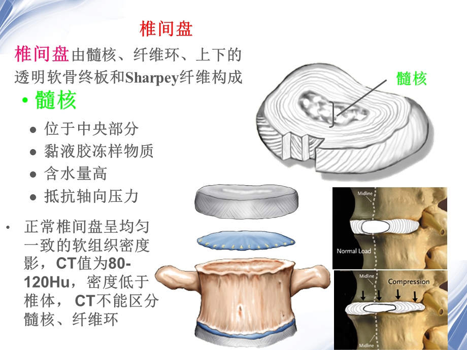 腰椎影像解剖及常见病变.ppt_第3页