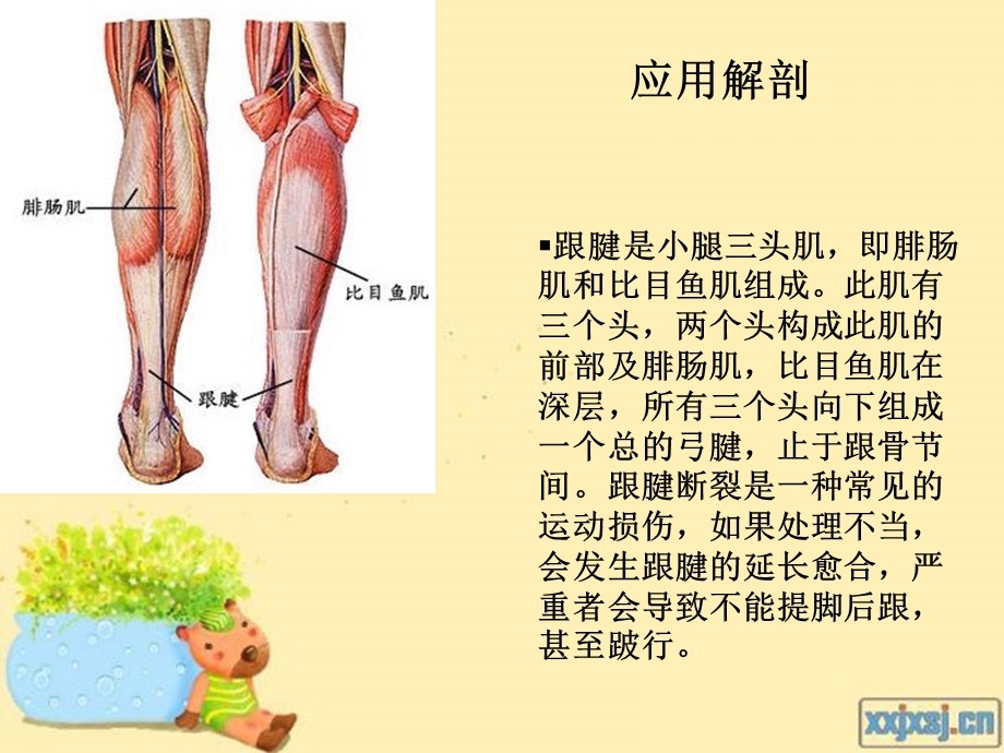 跟腱断裂患者的康复护理.ppt_第2页