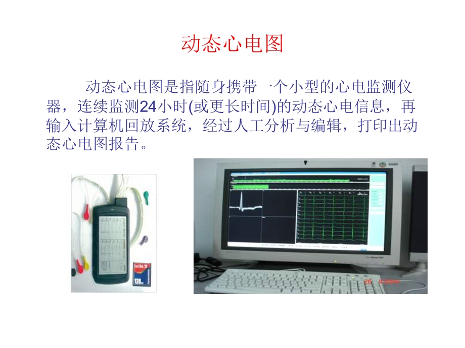 灿烂辉煌的心电图学动态心电图三大最新进展.ppt_第3页