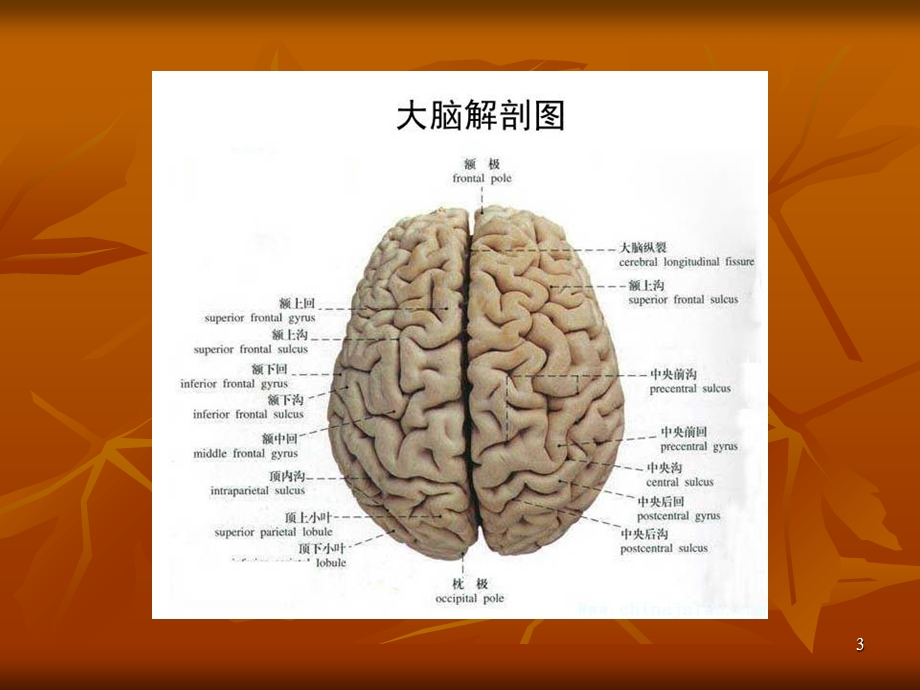 脊髓炎的护理查房PPT课件.ppt_第3页