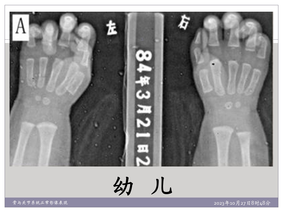 骨与关节系统正常影像表现.ppt_第1页