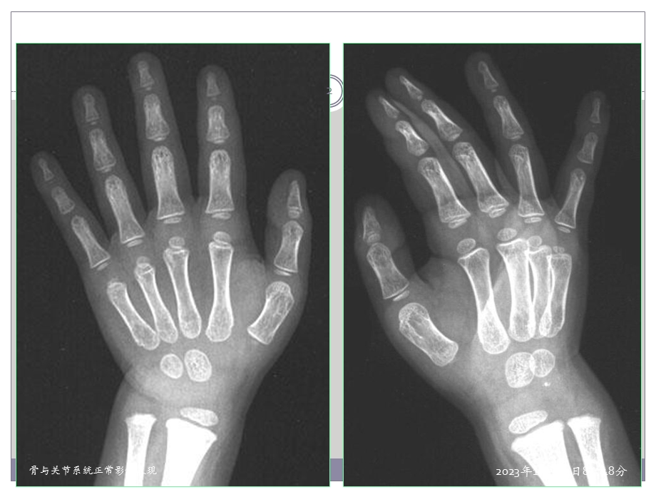 骨与关节系统正常影像表现.ppt_第2页