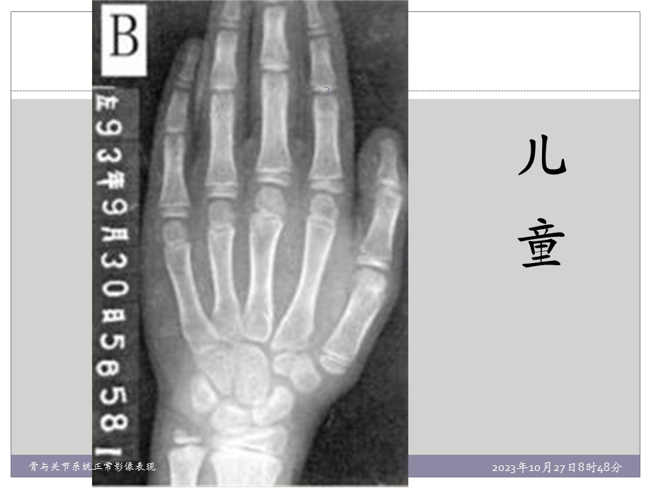 骨与关节系统正常影像表现.ppt_第3页