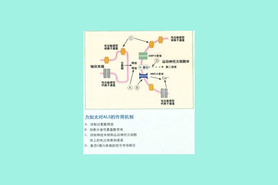 肌萎缩侧索硬化症.ppt_第2页