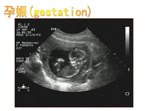 彩色多普勒超声的临床应用4.ppt