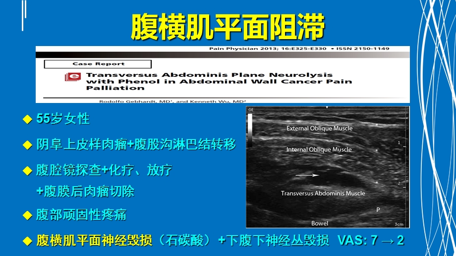 腹部神经阻滞应用解剖(沙龙).ppt_第3页