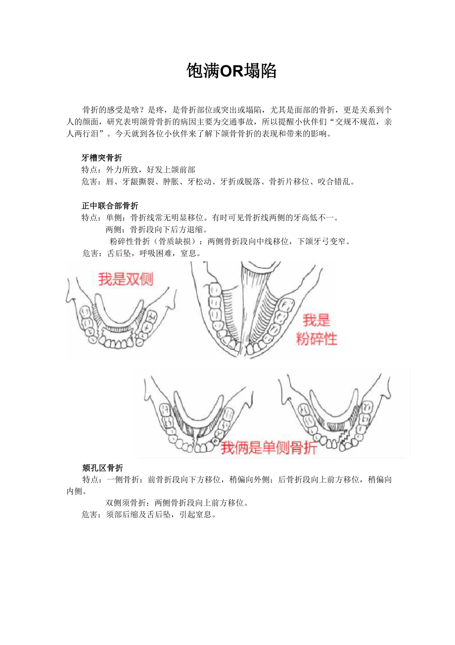 口腔颌面外科-颌骨骨折.docx_第1页