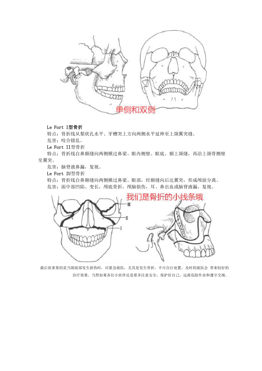 口腔颌面外科-颌骨骨折.docx_第3页