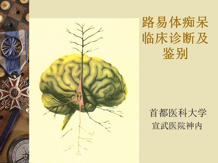 路易体痴呆临床诊断与鉴别PPT.ppt_第1页