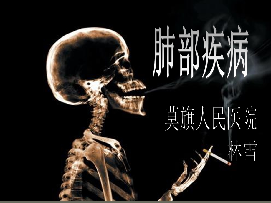 肺部疾病的x诊断.ppt_第1页