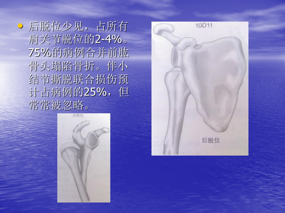 骨折与脱位-诊断分型及治疗.ppt_第3页