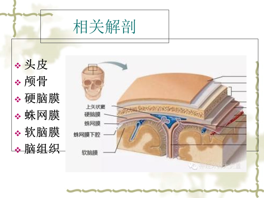 颅脑手术护理配合.ppt_第3页