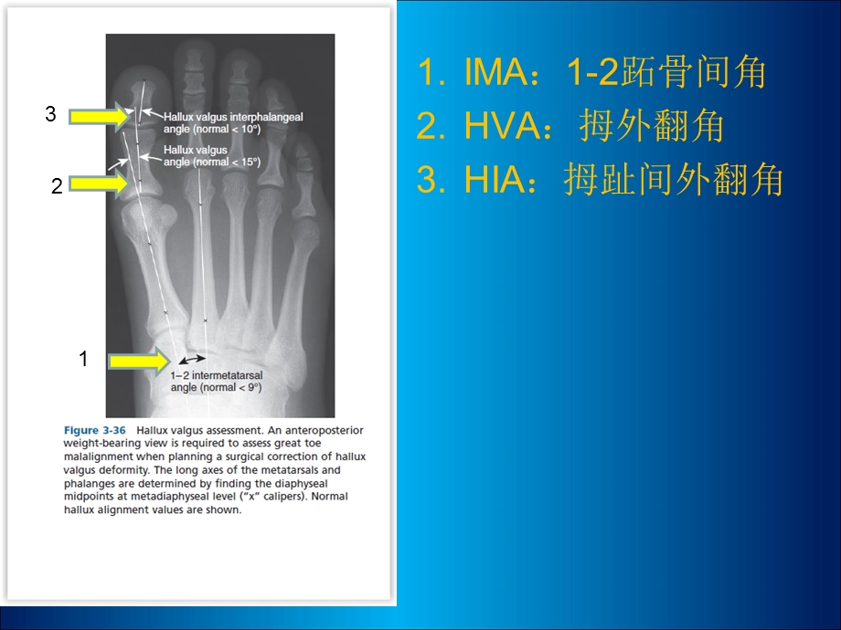 骨科角度测量需求.ppt_第3页