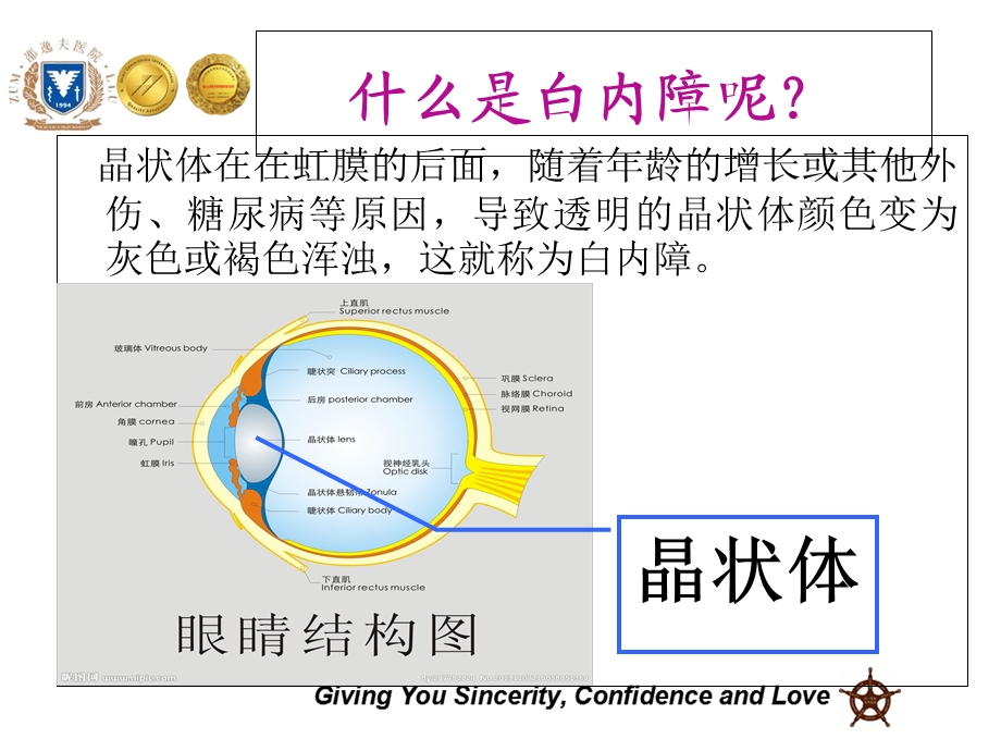 白内障术前宣教.ppt_第3页