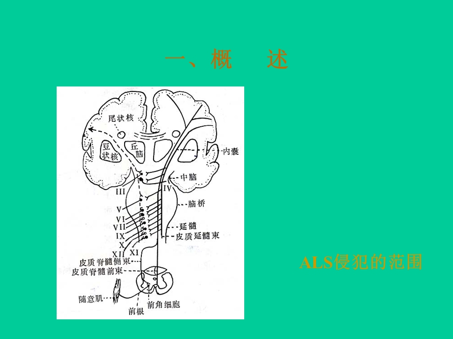 肌萎缩性侧索硬化的若干.ppt_第2页