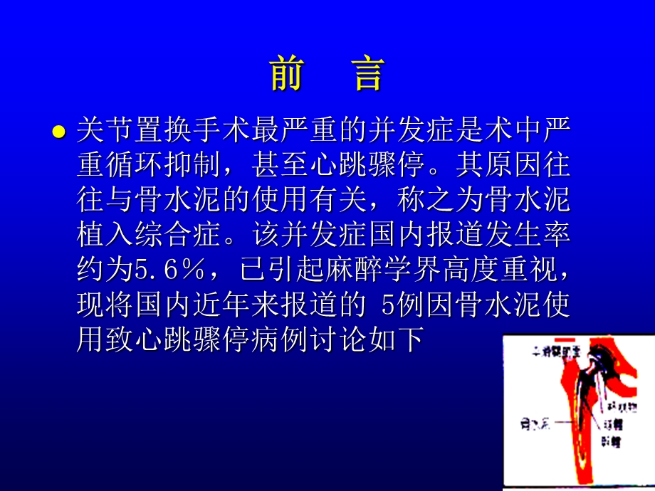 骨科手术中骨水泥毒性反应的预防.ppt_第2页