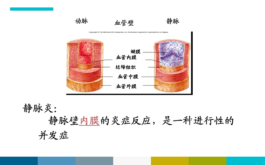 胺碘酮致静脉炎.ppt_第2页