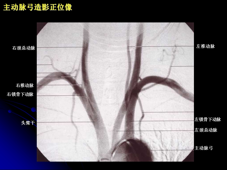 神经血管解剖图.ppt_第2页