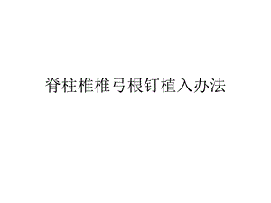 脊柱椎弓根螺钉置钉.ppt