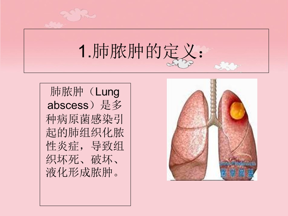 肺脓肿病人的护理查房.ppt_第2页