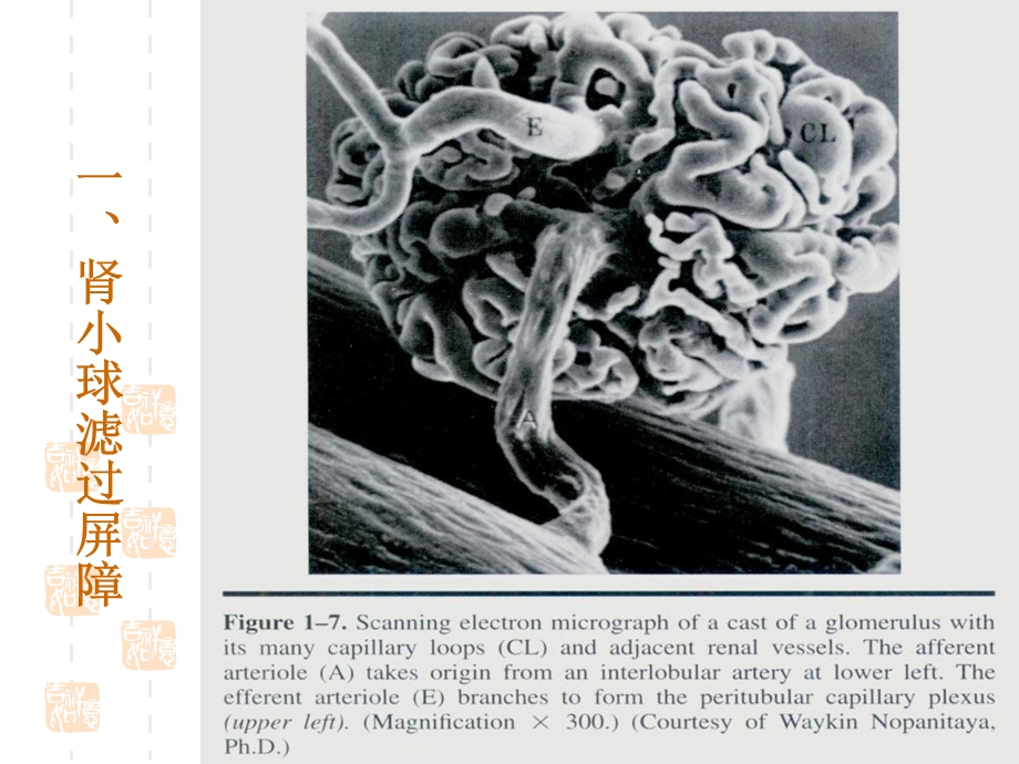 蛋白尿Proteinuria.ppt_第3页