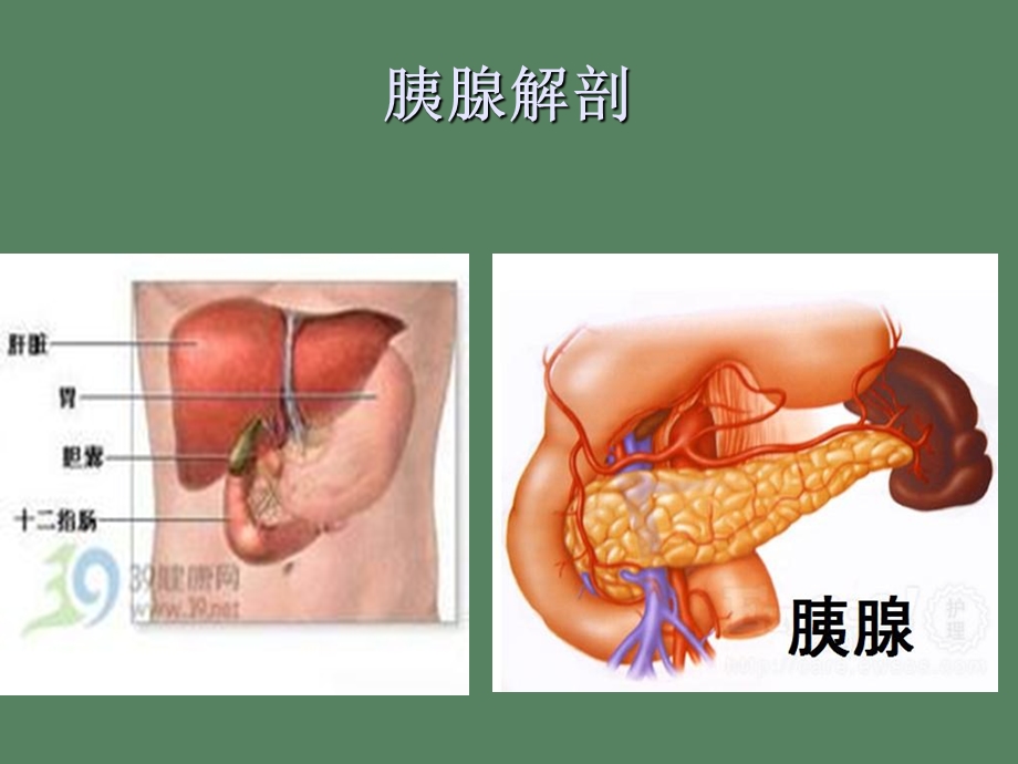 高脂血症性胰腺炎.ppt_第1页