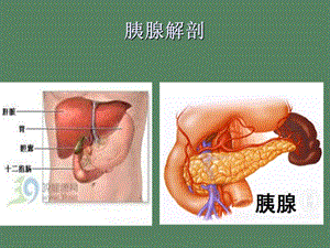 高脂血症性胰腺炎.ppt