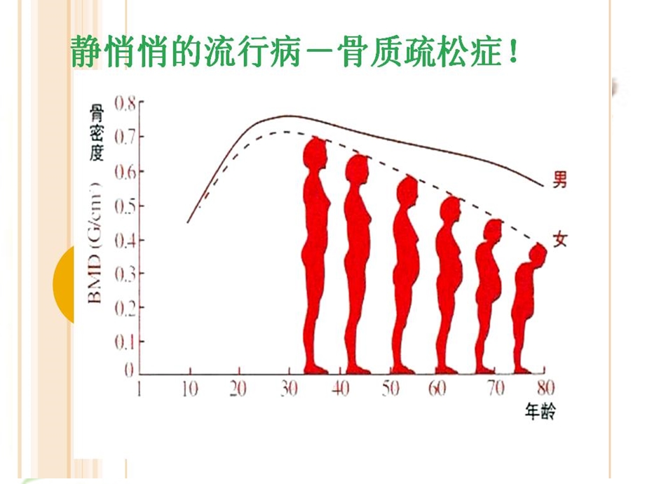 防止骨质疏松提高生活质量.ppt_第2页