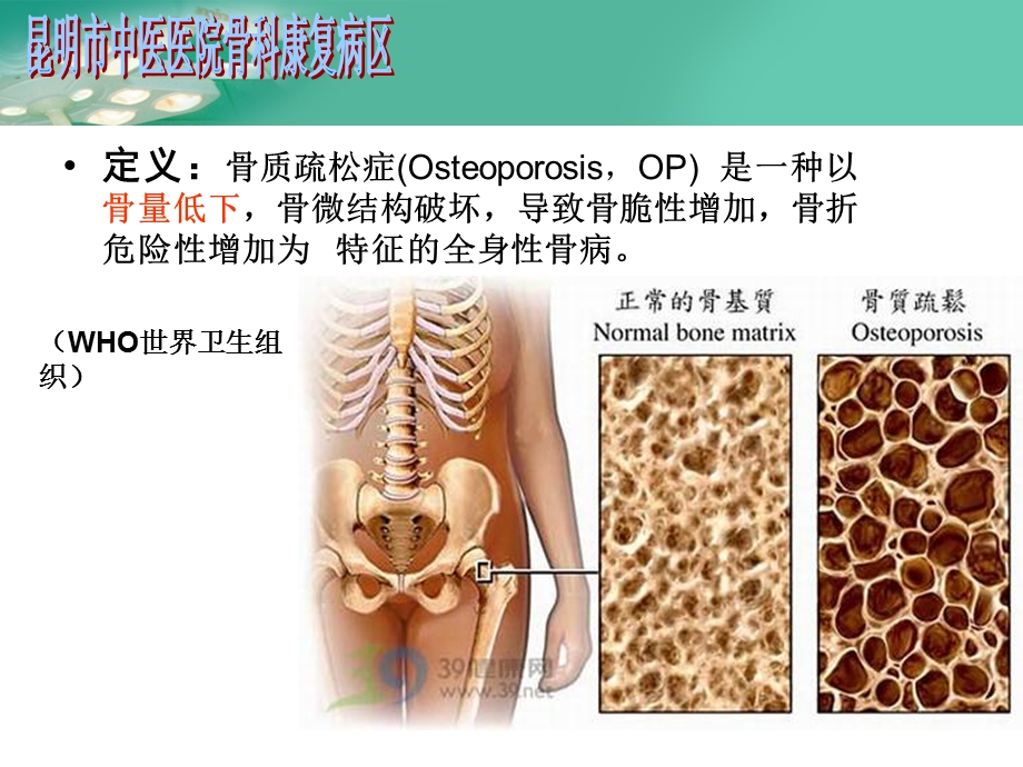 骨质疏松的诊疗.ppt_第3页