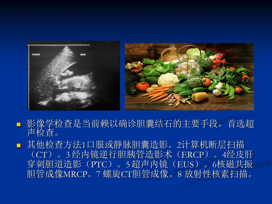 胆结石课件PPT.ppt_第3页