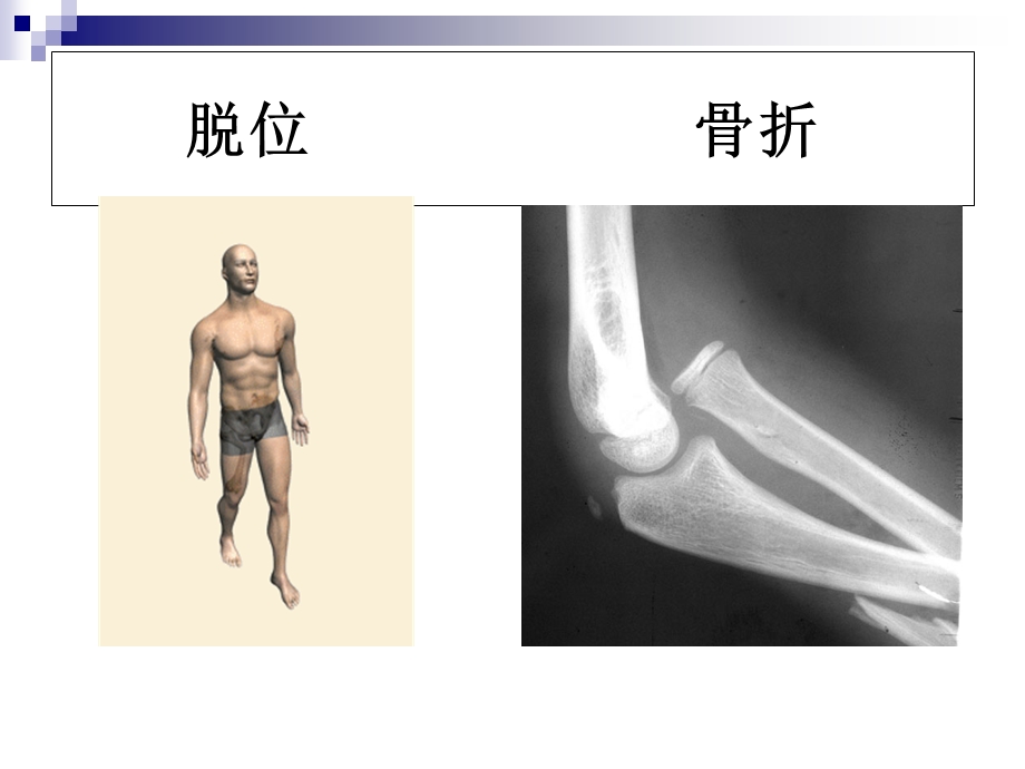 跌倒的有效管理.ppt_第3页