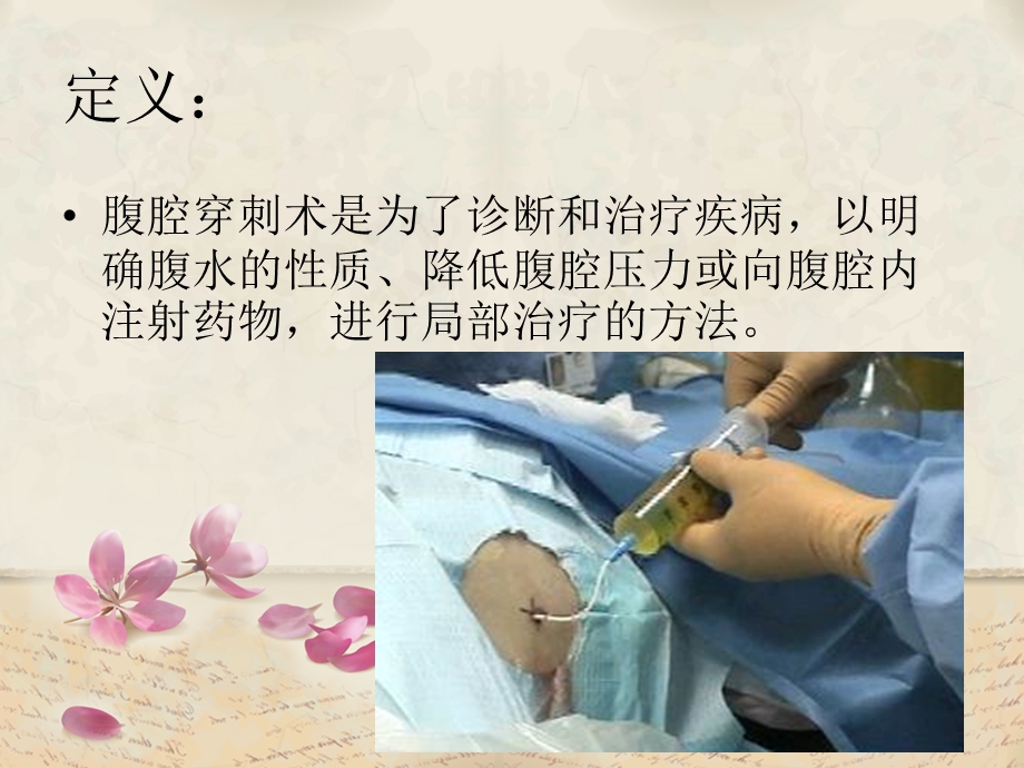 腹腔穿刺术及护理.ppt_第2页