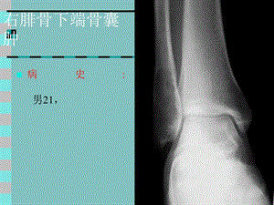 骨肿瘤X线病例图谱.ppt