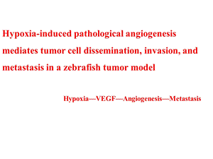缺氧导致的病理性血管再生与肿瘤迁移.ppt