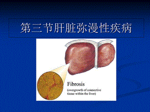 肝脏弥漫性疾病.ppt