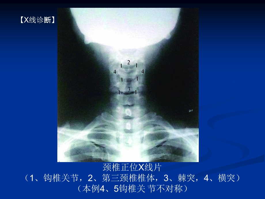 脊柱的影像学诊断.ppt_第2页