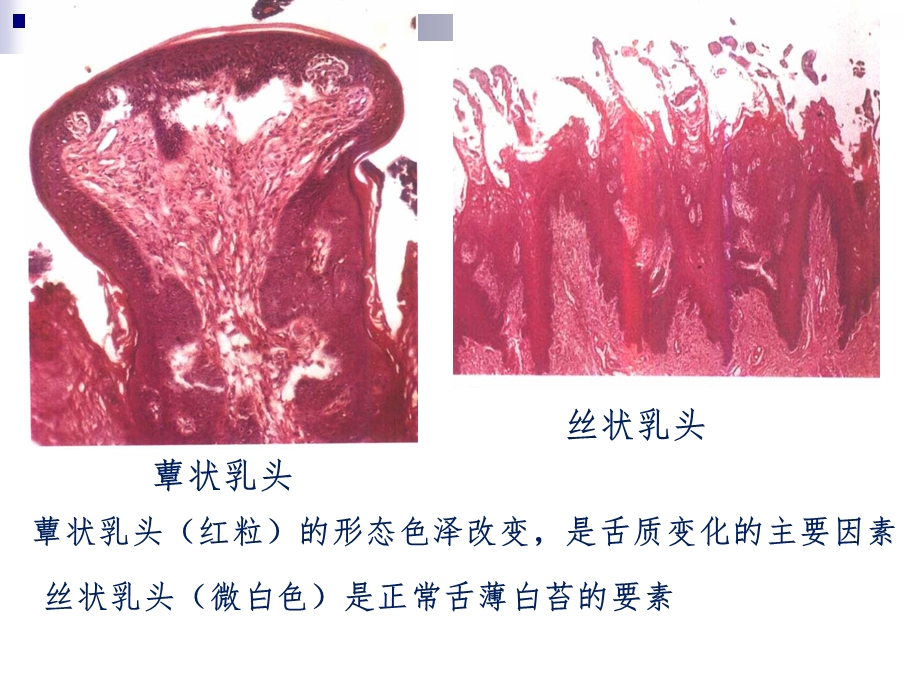 舌诊ppt课件.ppt_第3页