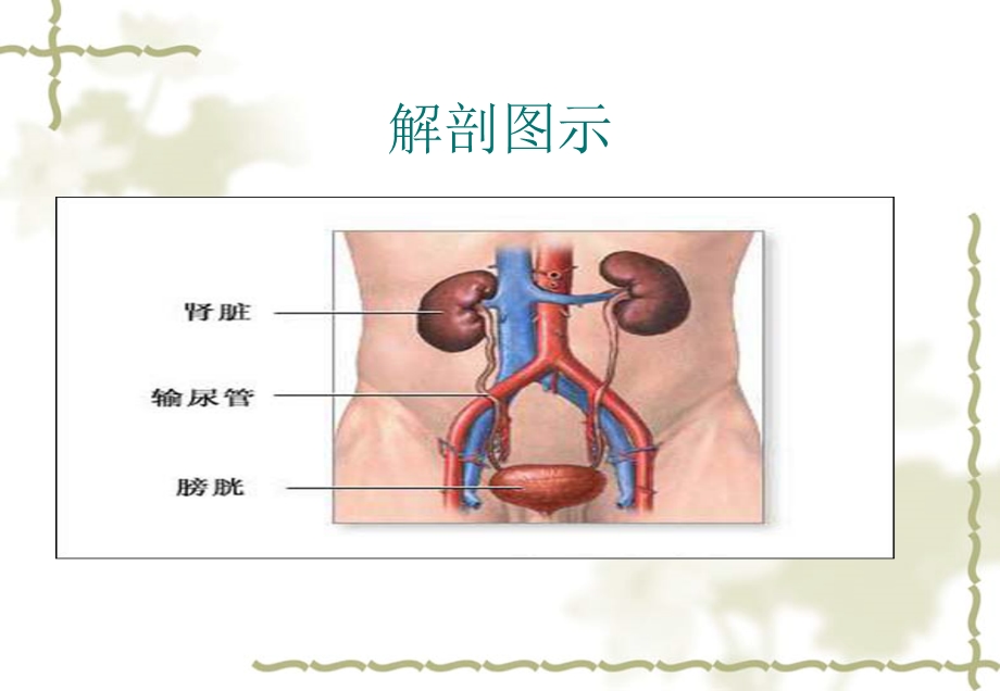 膀胱肿瘤的护理查房.ppt_第3页