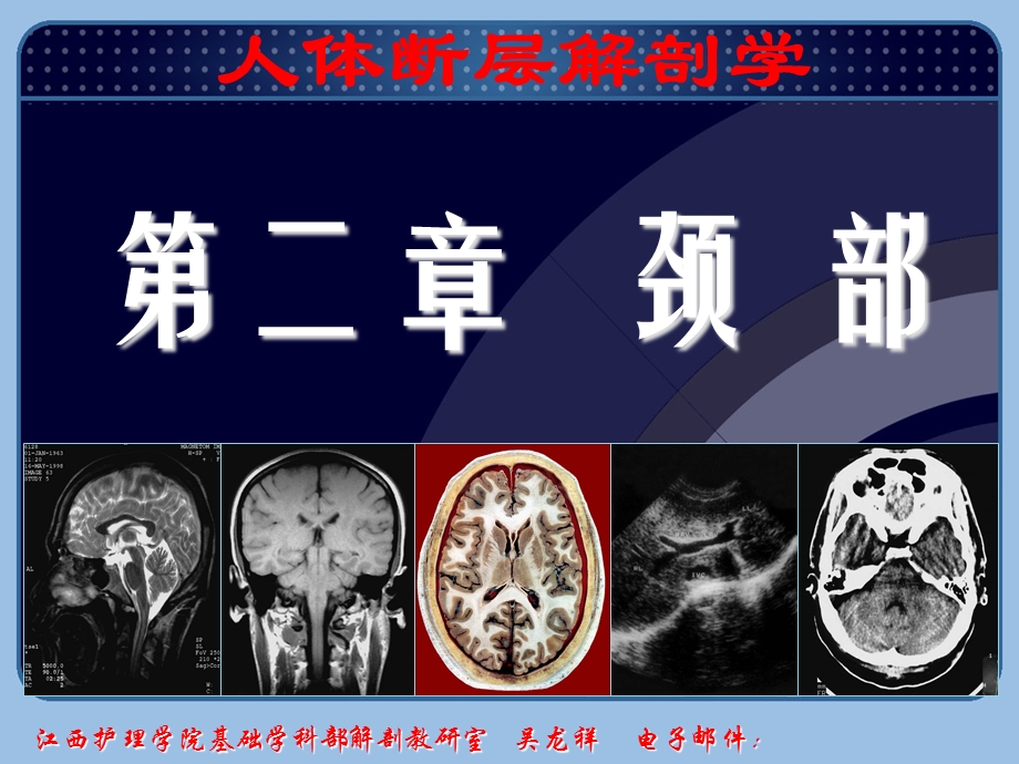 颈部断层解剖第二节颈部横断层解剖最终.ppt_第2页