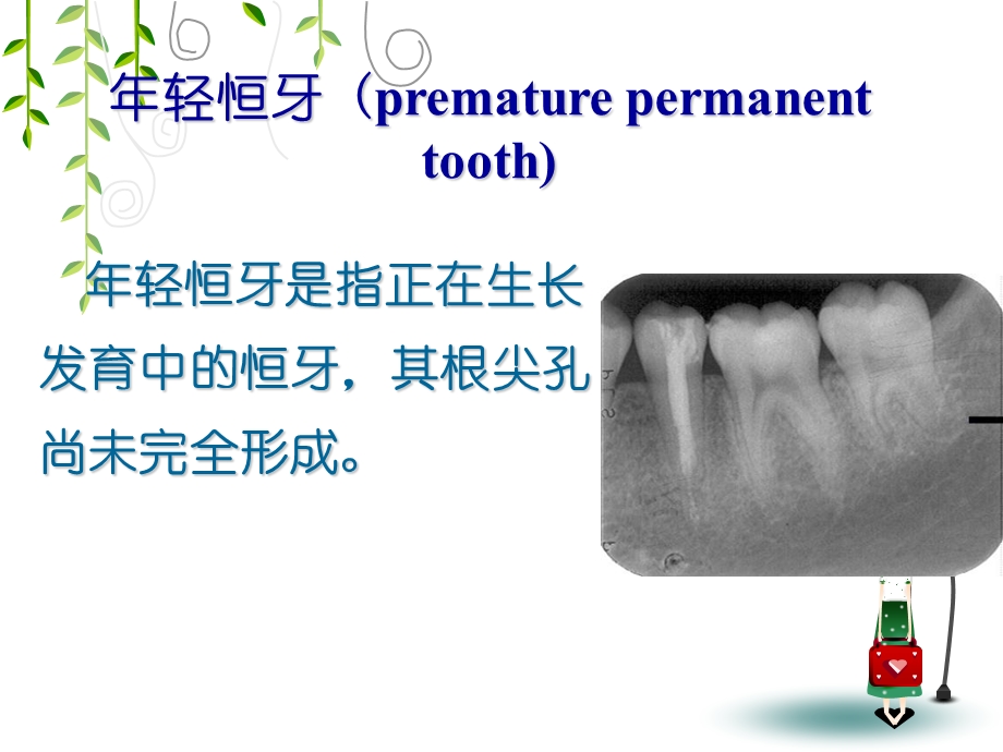 轻恒牙牙髓病和根尖周病.ppt_第2页