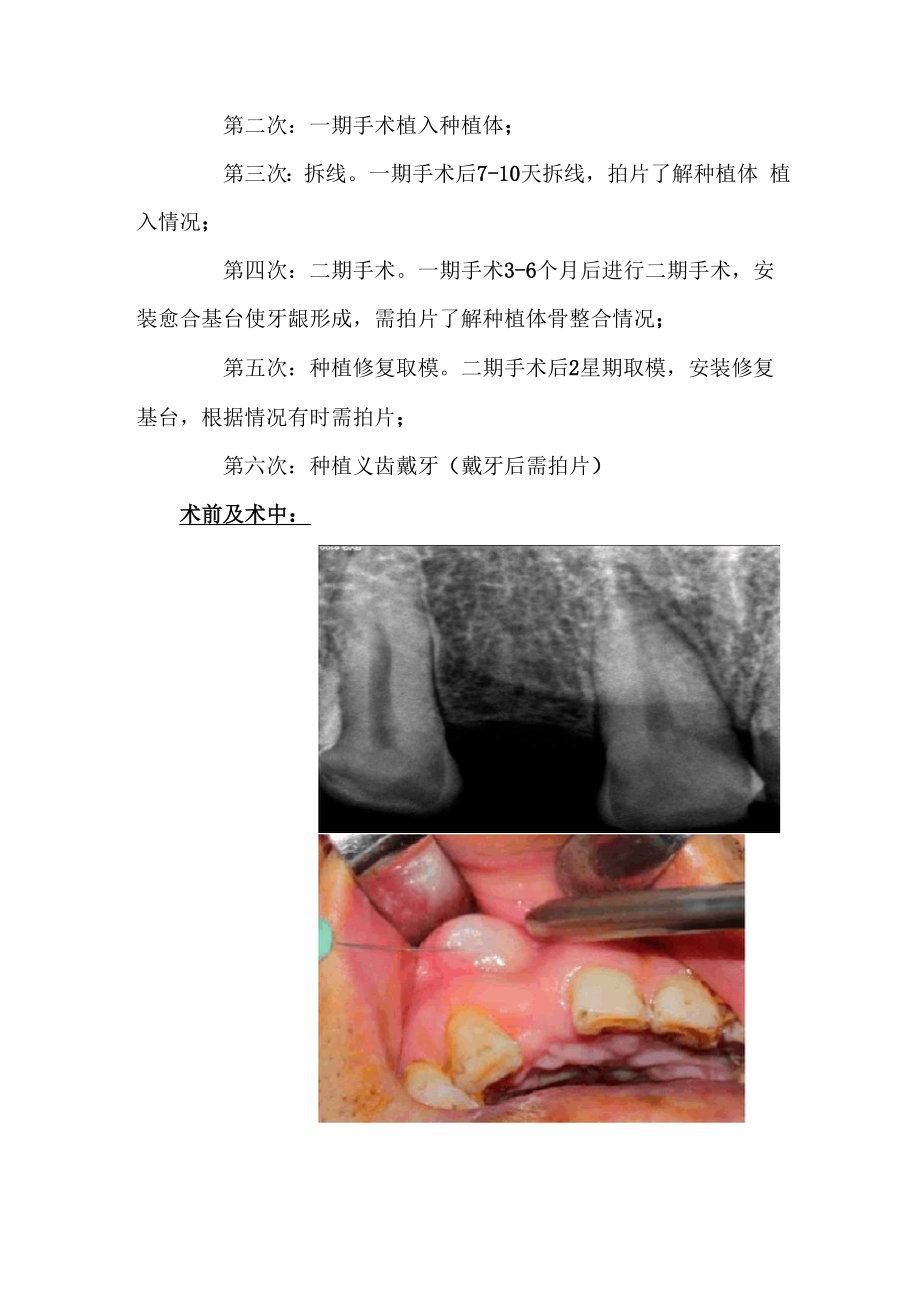 口腔科主要技术介绍.docx_第3页