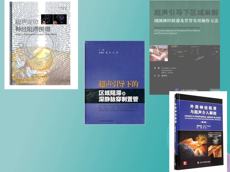 超声定位的下肢神经阻滞.ppt_第2页