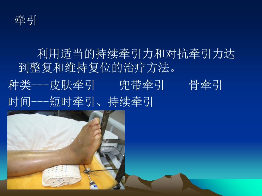 骨科一般护理牵引石膏.ppt_第2页