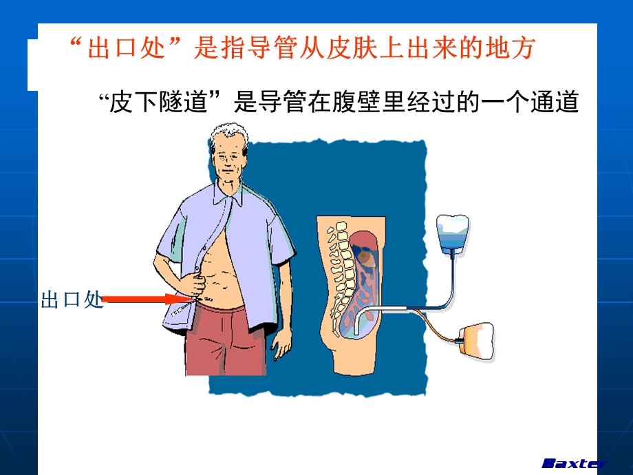 腹膜透析自我管理.ppt_第3页