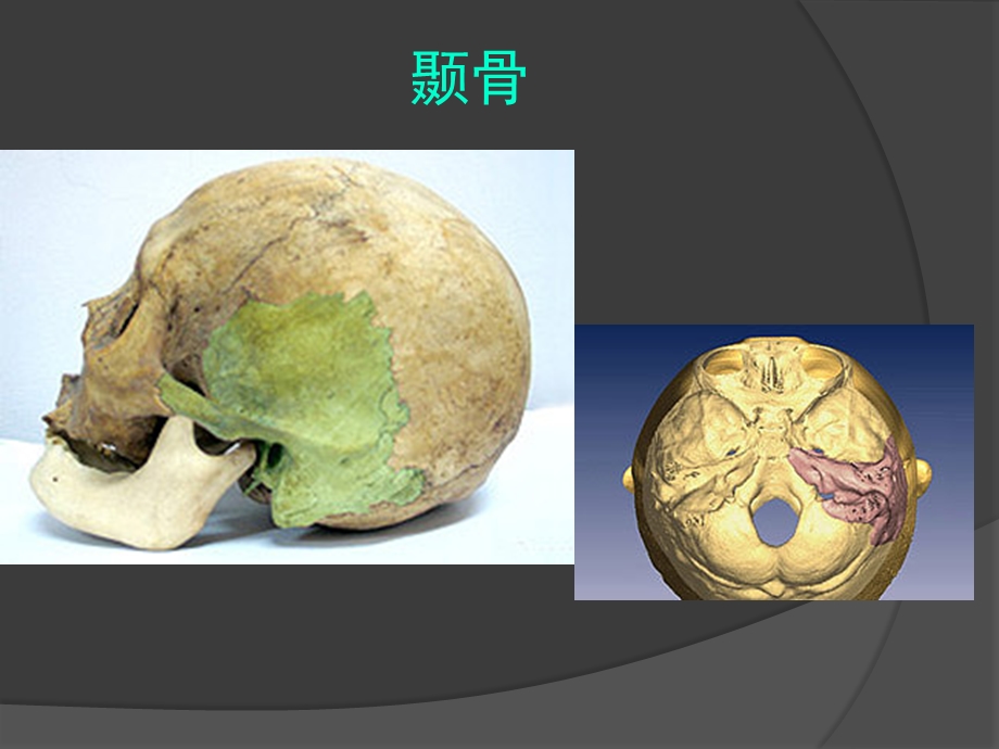 颞骨大体解剖及CT解剖.ppt_第3页